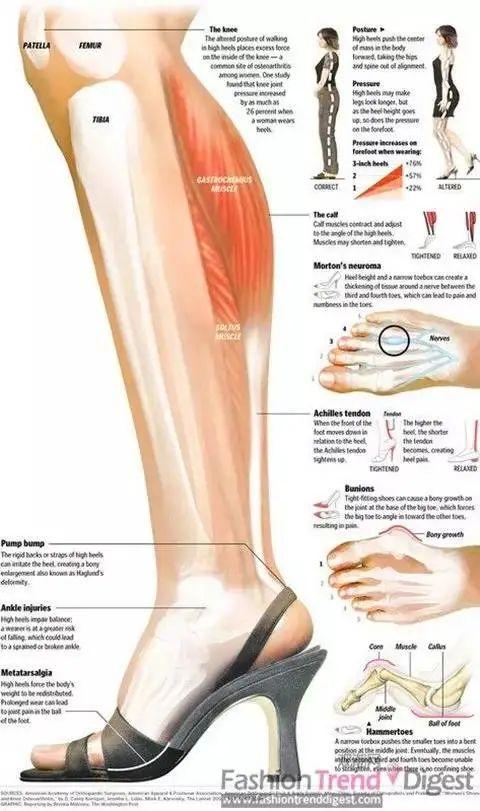 判断肌肉腿脂肪腿水肿腿_瘦小腿不同类型方法_瘦的人血脂高是什么原因