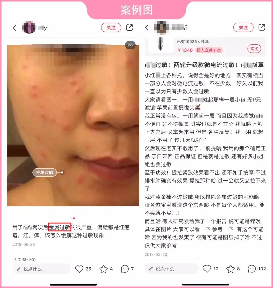美容面罩有用吗_日本美容仪过敏反应_铂金镀层美容仪检测