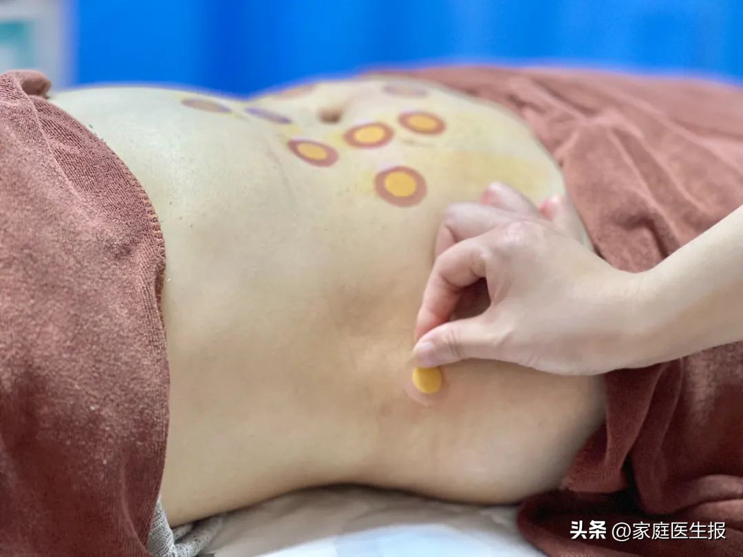 痰湿型肥胖埋线减肥_局部减肥有用吗_腹部埋线减肥优势