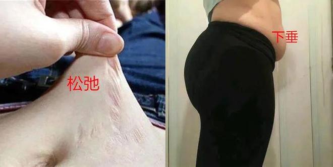 腰臀比_全身照VS自拍照_立式收腹机有效果吗