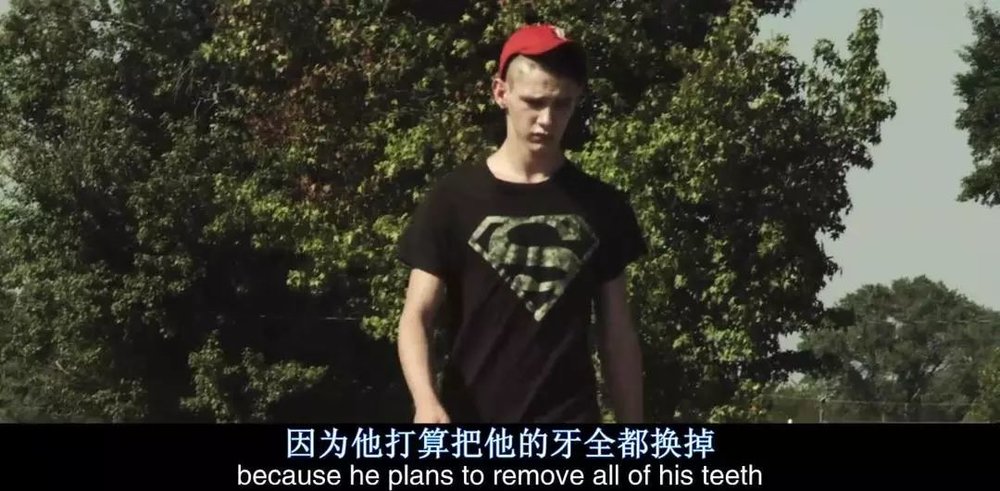 与糖的摄入量有直接关系的是_糖的成瘾性研究_添加糖危害