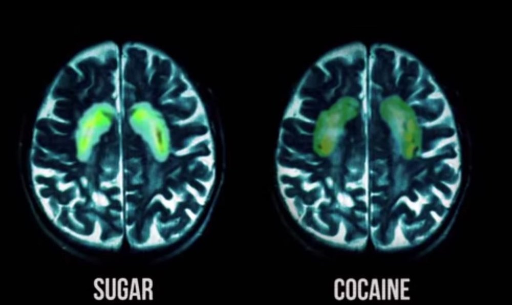添加糖危害_与糖的摄入量有直接关系的是_糖的成瘾性研究
