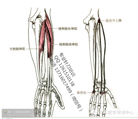 针刀医学肌肉起止点解析_肌肉是止点向起点收缩_尺侧腕伸肌功能与解剖