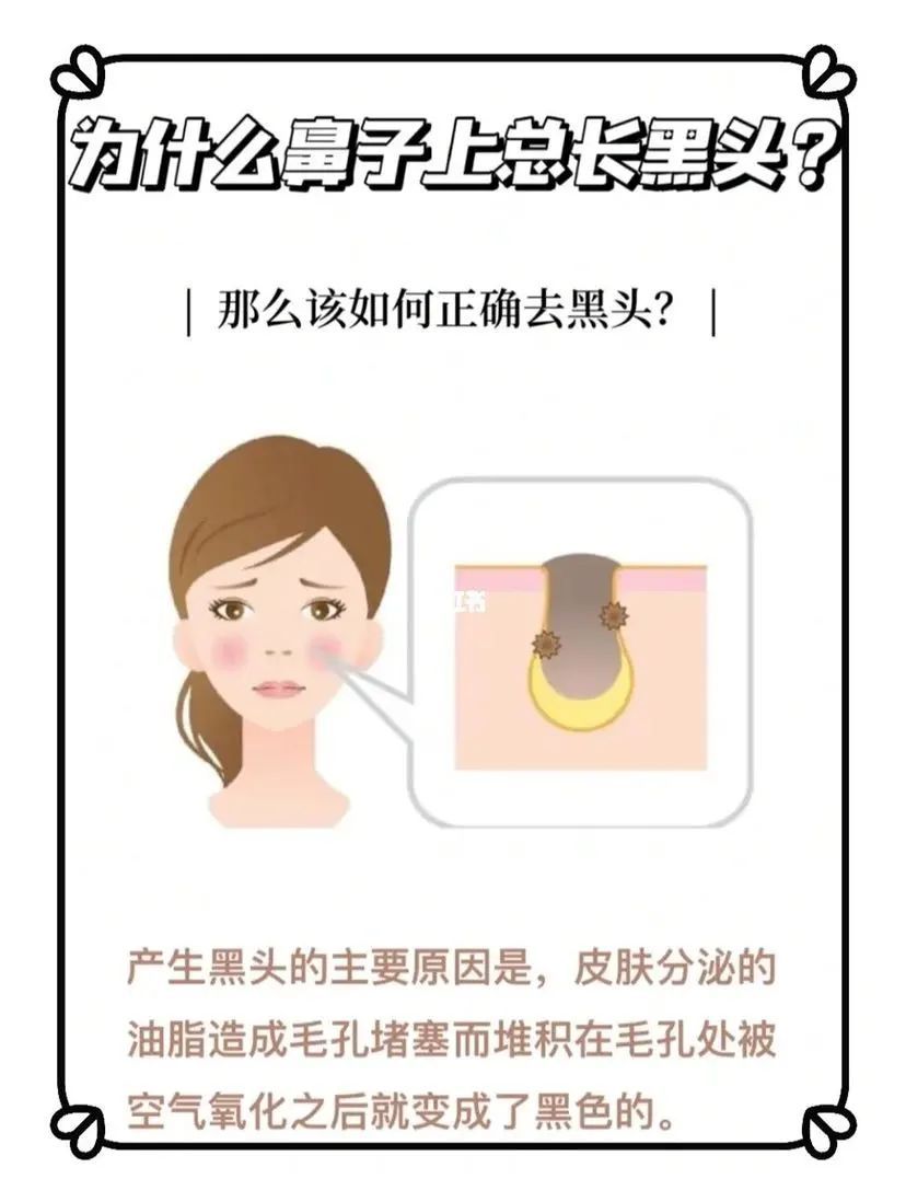 黑头成因及解决方法_用盐去黑头的正确方法_科学祛黑头步骤
