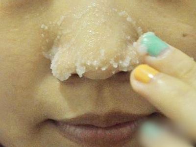 食盐洗脸_用盐去黑头的正确方法_去黑头食盐方法