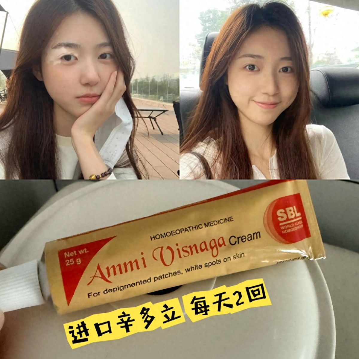 问鼎娱乐官网下载 氧化应激水平降低对皮肤色素异常病情好转的影响解析报告
