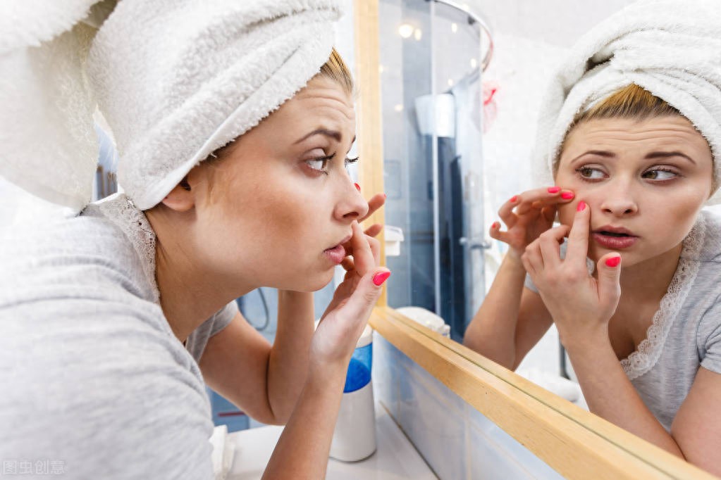 痘痘怎么挤不留印_能挤的痘痘_痘痘里的血要挤干净吗