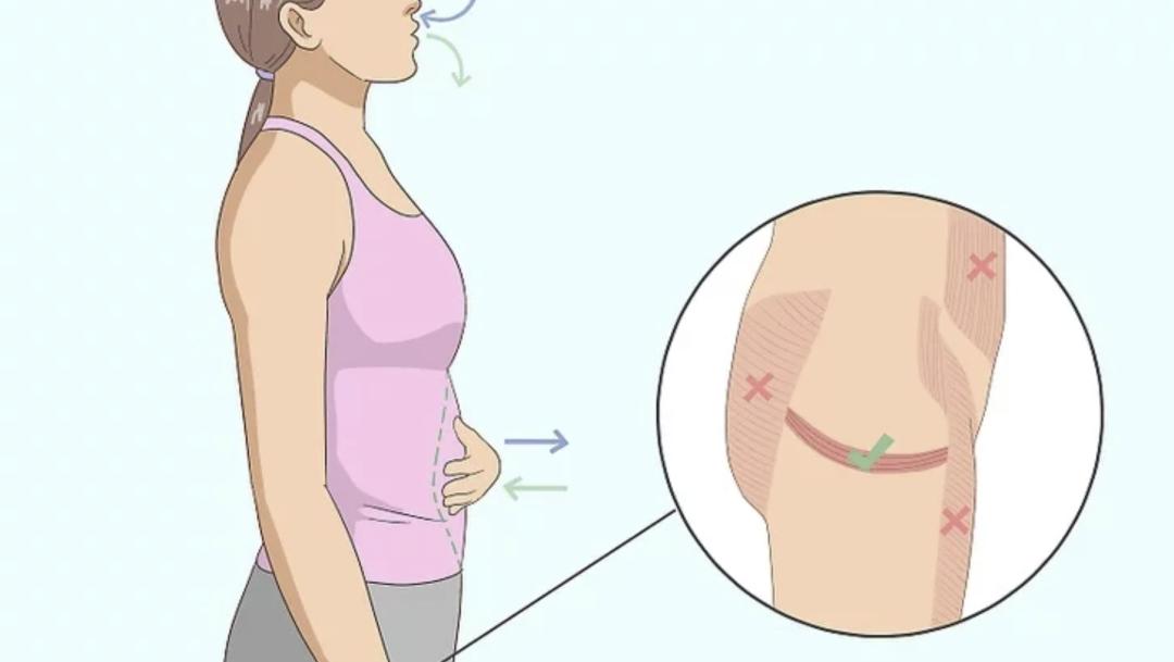 妇产科医生方芳_凯格尔运动什么时候做_凯格尔运动产后修复