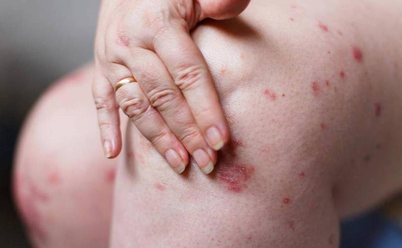 多吃酱油皮肤会变黑吗_酱油变皮肤黑吃会变白吗_酱油变皮肤黑吃会怎么样